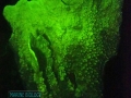 Millepora platyphylla